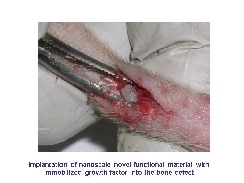Implantation of nanoscale novel functional material with immobilized growth factor into the bone defect